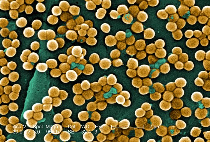 Just_staphylococcus_aureus